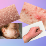 Handgemachte Seifen – Warum kaltgesiedet so besonders ist! ❄️